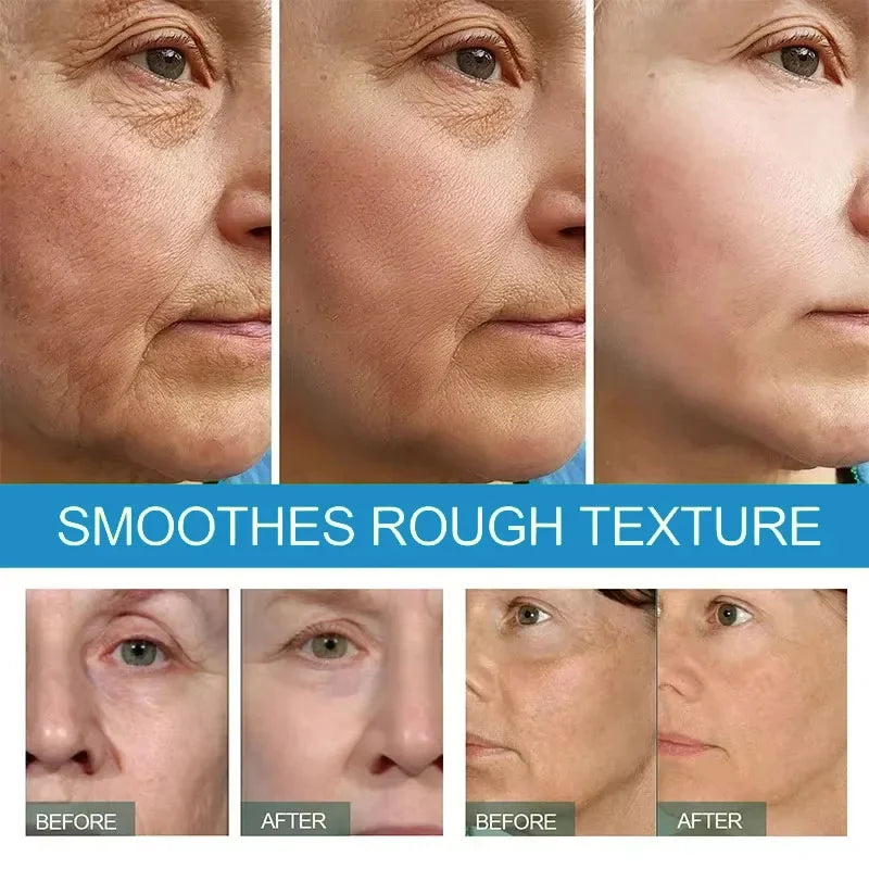 SERUM V89™️ SERUM FACIAL CON ACIDO HIALURONICO V89, REPARADOR DE LINEAS DE EXPRESION MANCHAS Y ARRUGAS