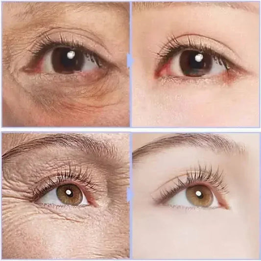 SKIN EYES™️ CREMA INSTANTANEA PARA OJOS ANTIENVEJECIMIENTO